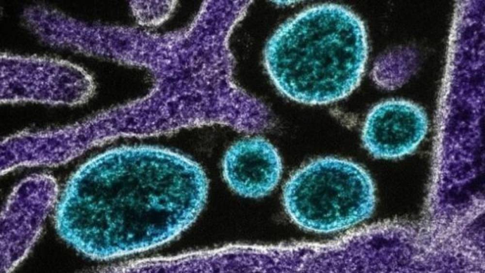 “M pox” virusu Qanada yayılmaqda davam edir