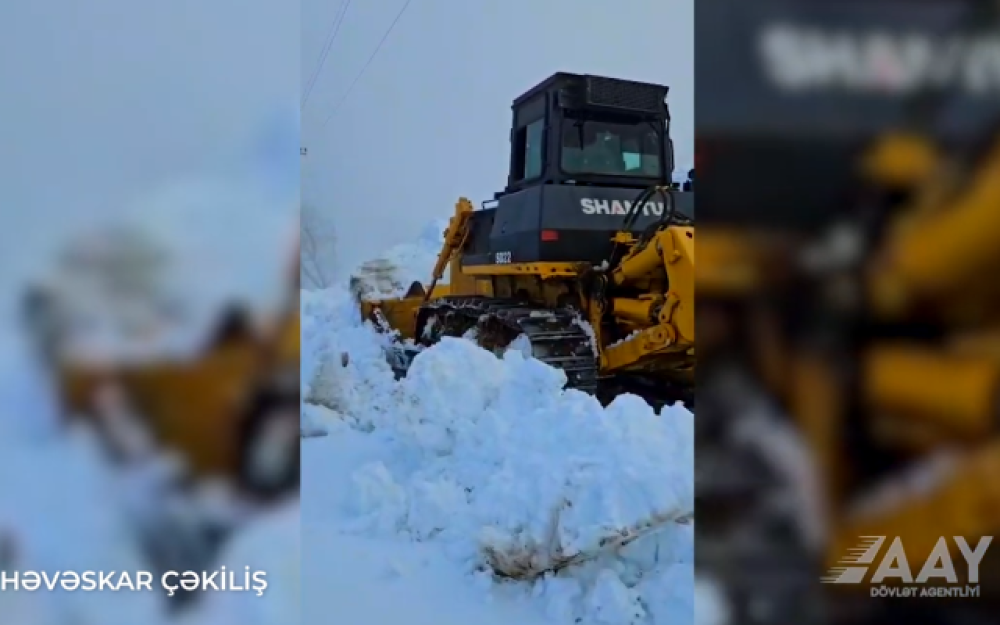 Güclü qarın yaratdığı fəsadlar aradan qaldırılıb - VİDEO